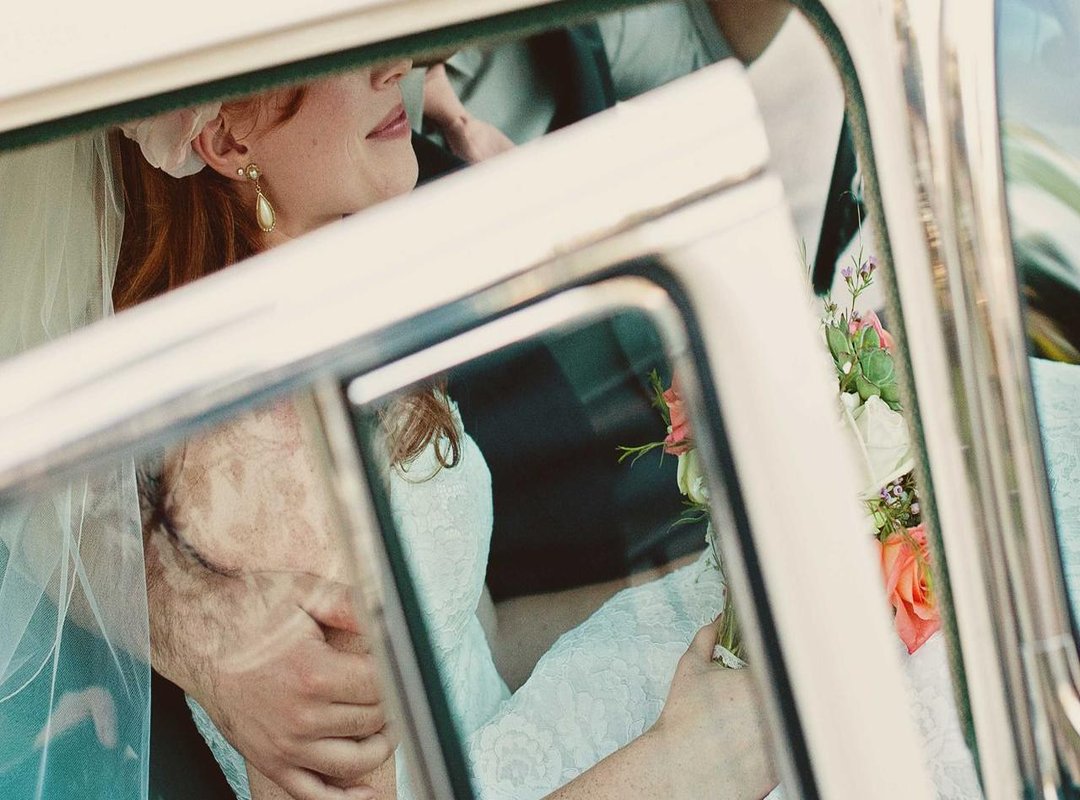 The Psychology of Recognition: Why It Hurts So Much